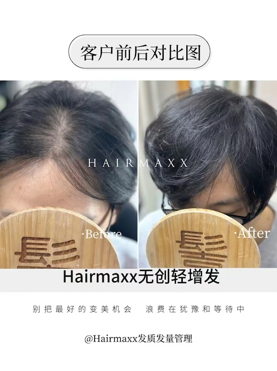 没有什么比一个下午就拥有发量爆棚的感觉更香了(*^▽^*) 