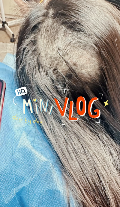 从周末到今天 每天都在想怎么能够达到更好的效果 内在头发太短 但还希望能够无死角的遮盖 