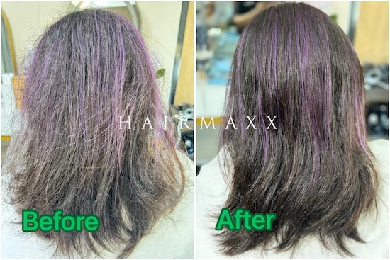 Hairmaxx的日系毛发整形项目  是一个综合的项目  根据您的头发为您出谋划策