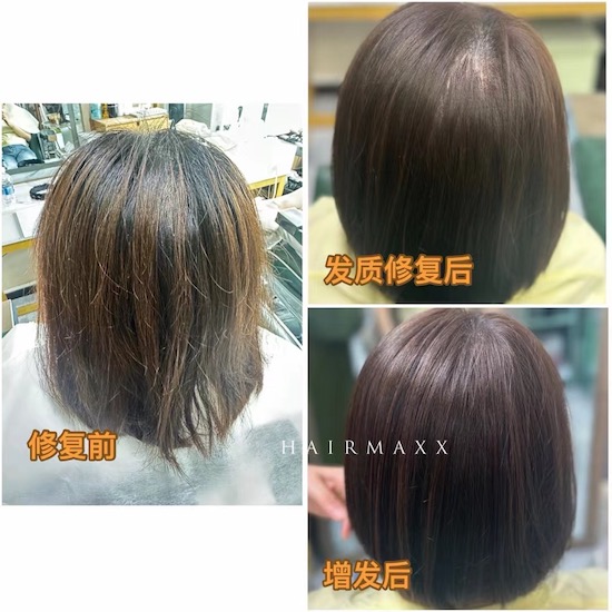 漂染过多次的发质  颜色容易发黄 头顶又比较稀少  显得头发质感比较差