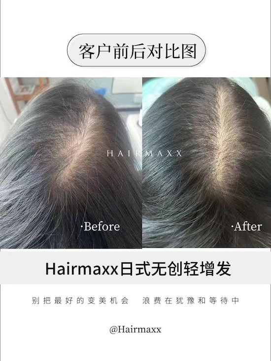 上海接下来的高温  让我想到你们可以这样让头发变多  还不热(｀∀´)