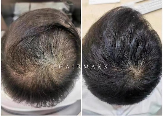 小哥哥已经是第三次来店了 之前把头发修的太短了