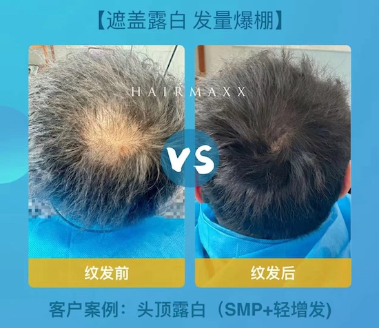 当smp遇上了pphair 发少星人的有效方法  强调一下：现在这个天气操作正当时