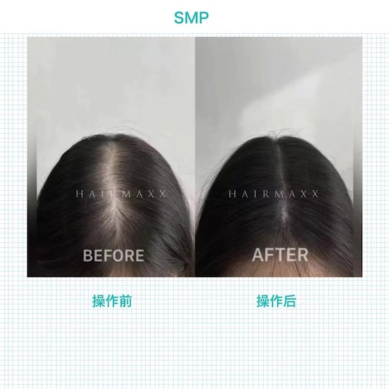 SMP填补空白的更优之选 趁着现在天气好进行操作可以美美哒出门了