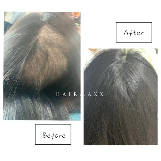 困扰小姐姐10几年的问题 今天通过增发+SMP解决 才做完长征的一半 